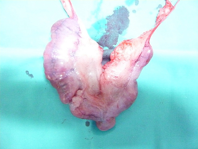 子宮蓄膿症によって切除した卵巣・子宮